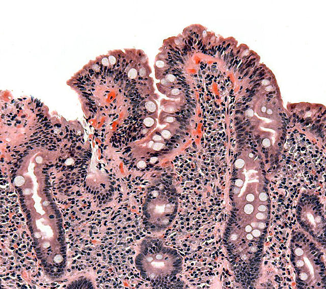 640px-Coeliac_path